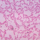 Image: CDC/Wikimedia Commons